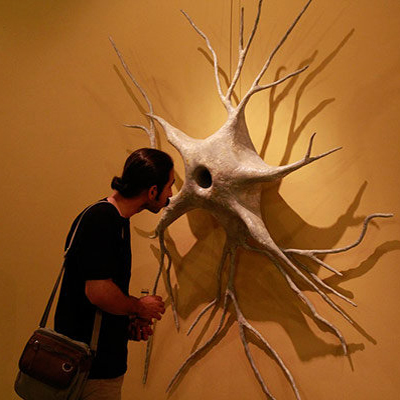 افتتاح نمایشگاه «سمفونی لک لک ها» با موضوع بیماری ام اس